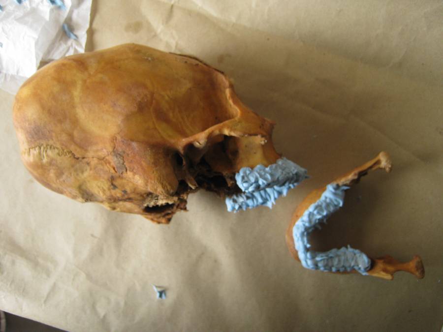 Here is a skull, I believe with deformation, with its mandible drying with the goo on.